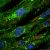 Electrical Stimulation Induces Myogenic Differentiation of Human Dermal Fibroblasts