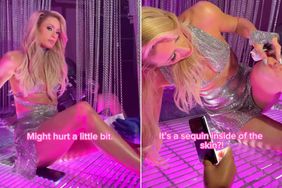 Paris hilton cuts her knee during video shoot instagram 09 02 24