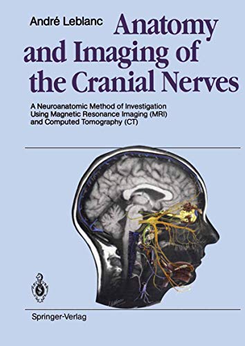 Anatomy and Imaging of the Cranial Nerves: A Neuroanatomic Method of ...