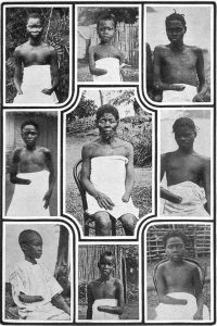 A photograph of children missing limbs from the Belgian Congo