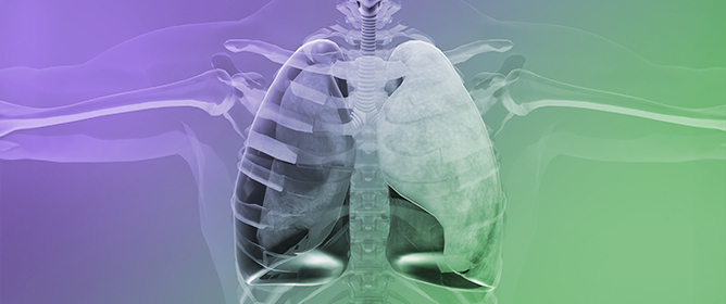 A Comprehensive Study of Reactive Oxygen Species Explicit Dosimetry for Pleural Photodynamic Therapy