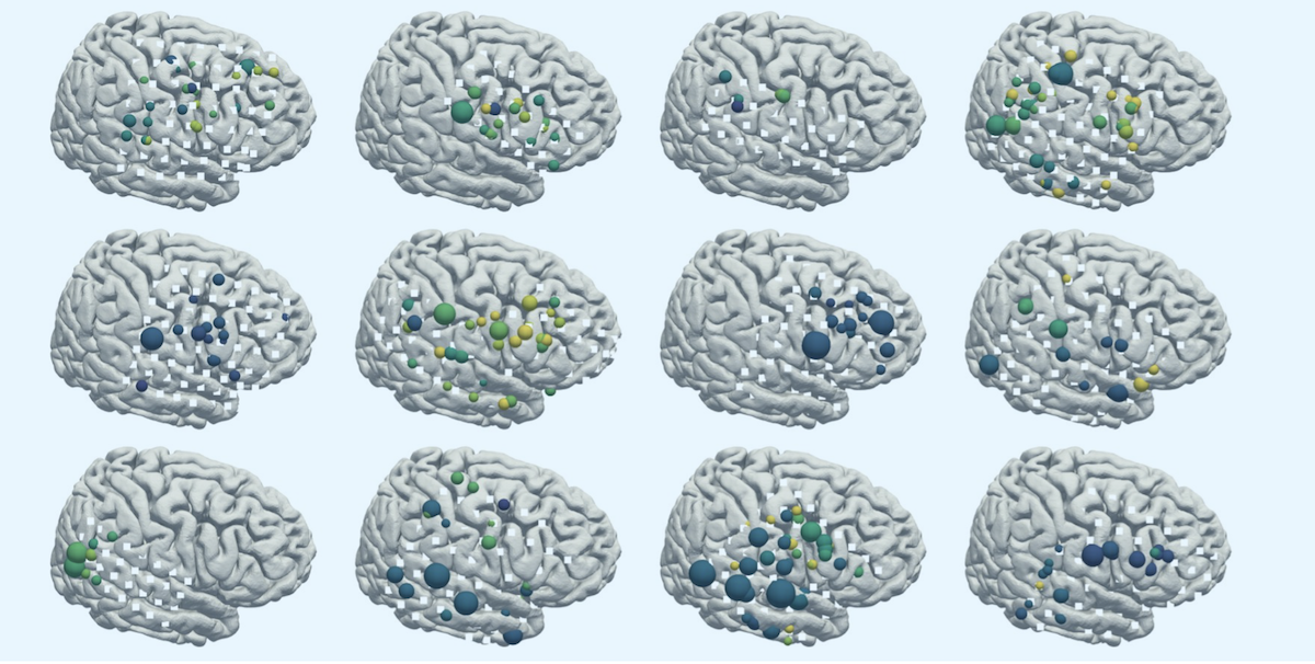 ieeg-spatial-filters-ssd