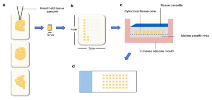 High throughput tissue microarray; Neurodegenerative Pathology Research ...