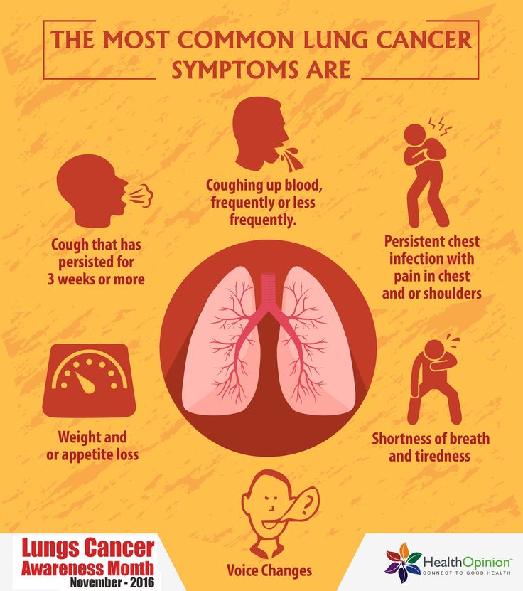 cause of lung cancer - DriverLayer Search Engine