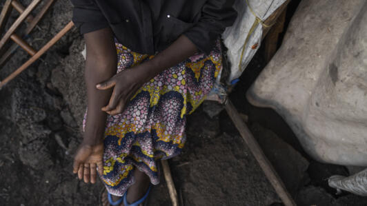 Une femme du camp de réfugié de Bulengo à Goma en RDC suspecte être atteinte du virus mpox, le 15 août 2024.