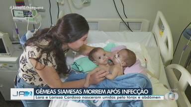 Morrem gêmeas siamesas que nasceram unidas pelo tórax e abdômem - Lara e Larissa Cardoso nasceram unidas pelo tórax e abdômen.