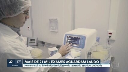 SP tem mais de 21 mil exames da Covid-19 na fila de espera