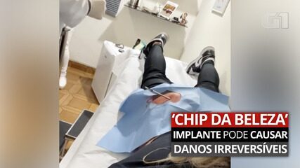 Chip da beleza: implante hormonal para fins estéticos pode causar danos irreversíveis