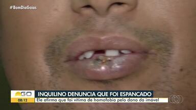 Inquilino denuncia que foi vítima de homofobia ao ser espancado por dono de imóvel - Morador disse que agressão aconteceu após o homem pedir que ele saísse do imóvel e cobrar, além do valor do aluguel, mais R$ 90 – o que ele teria se recusado a pagar. Polícia investiga.