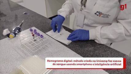 Hemograma digital: método criado na Unicamp faz exame de sangue usando smartphone