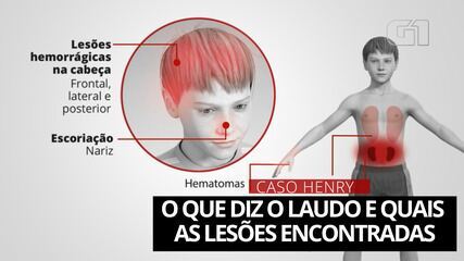 Morte Henry: o que diz o laudo e quais foram as lesões encontradas no corpo do menino