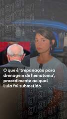 O que é 'trepanação para drenagem de hematoma', procedimento ao qual Lula foi submetido