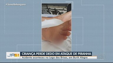 Criança que perdeu dedo do após ataque de piranha recebe alta de hospital em Buriti Alegre - Médico colocou prótese para garoto ter a sensação de que ainda tem o dedo. Pai relatou que o menino brincava com primos na parte rasa do lago quando deu um grito de dor.