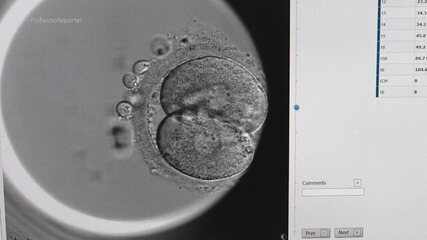 Profissão Repórter mostrou nova técnica de congelamento de óvulos