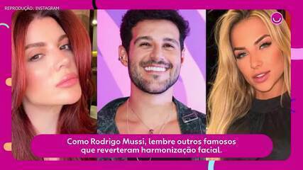 Como Rodrigo Mussi, lembre outros famosos que reverteram harmonização facial