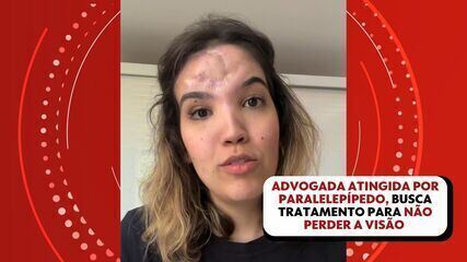 Um ano após ataque com paralelepípedo, advogada busca tratamento para não perder a visão