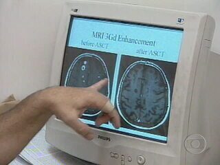 Reportagem de Graziela Azevedo sobre o avanço no tratamento de doenças consideradas incuráveis a partir do uso das células-tronco, Globo Repórter, 14/01/2005.