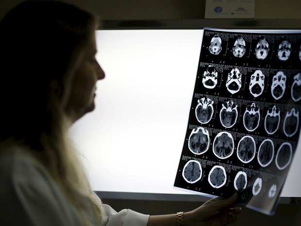  Neuropediatra Vanessa Van Der Linden observa exame de imagem de um bebê com microcefalia no Hospital Barão de Lucena, no Refife, Brasil, em foto de 26 de janeiro (Foto: Reuters/Ueslei Marcelino)