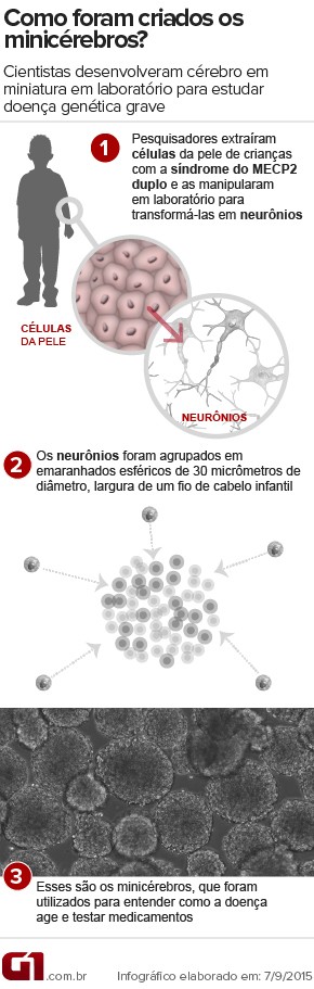 Minicérebros - Infográfico - Pesquisa do Alysson Muotri, síndrome do MECP2