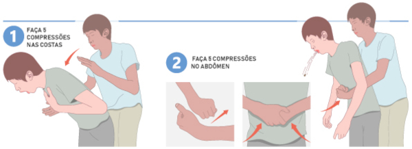 Demonstração da manobra de Heimlich em crianças e adultos.