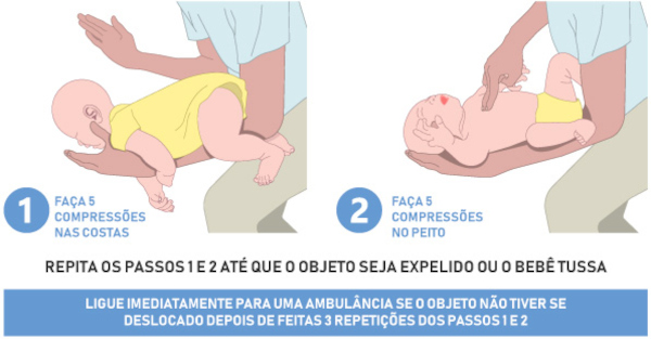 Demonstração da manobra de Heimlich em bebês.