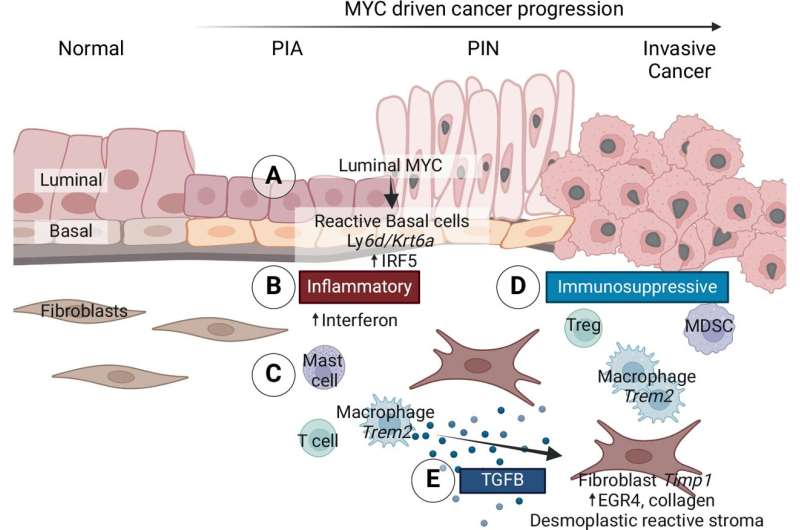 Estudio: la actividad de las proteínas cancerosas aumenta el desarrollo del cáncer de próstata