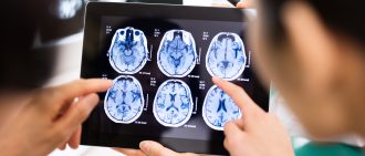 Understanding Surgery for Brain Tumors