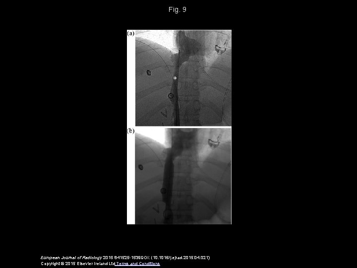 Fig. 9 European Journal of Radiology 2015 841525 -1539 DOI: (10. 1016/j. ejrad. 2015.