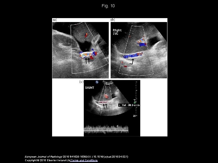 Fig. 10 European Journal of Radiology 2015 841525 -1539 DOI: (10. 1016/j. ejrad. 2015.