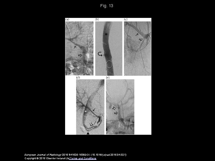 Fig. 13 European Journal of Radiology 2015 841525 -1539 DOI: (10. 1016/j. ejrad. 2015.