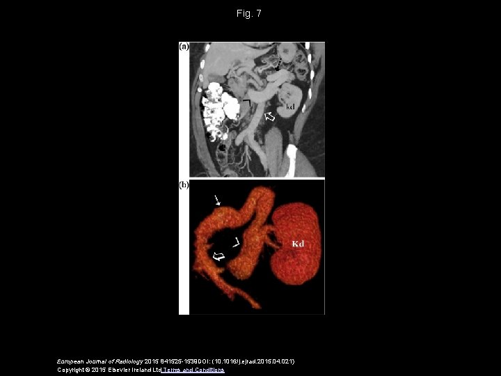 Fig. 7 European Journal of Radiology 2015 841525 -1539 DOI: (10. 1016/j. ejrad. 2015.