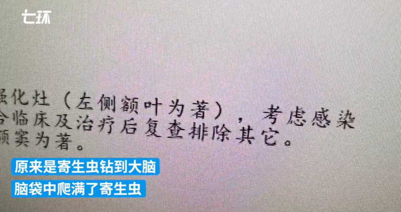 六旬男子愛喝「生豬血」造成腦中有寄生蟲盤踞。（圖／翻攝自澎湃新聞）  