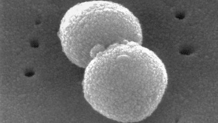 This electron microscopic image provided by the Centers for Disease Control and Prevention depicts two Gram-positive, Streptococcus pneumoniae bacteria