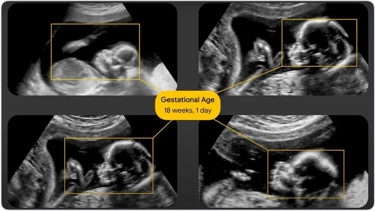 social_impact_ultrasound