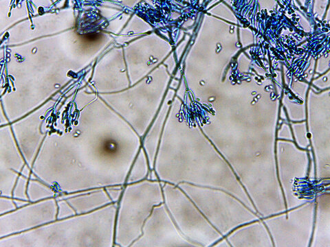 photo of fungi mold mycelium growth and spores under the microscope