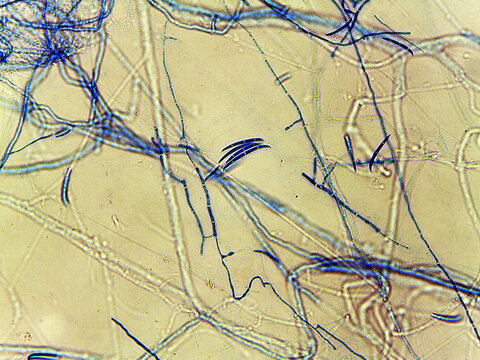 photo of fungi mold mycelium growth and spores under the microscope