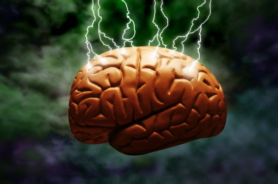 Image of a brain with electricity