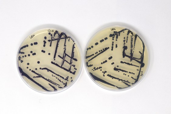 Bacterial dye in petri dishes.