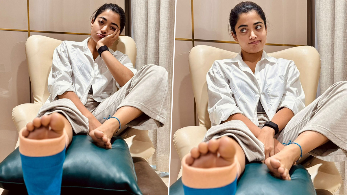 Rashmika Mandanna Injured: రష్మిక కాలు విరిగింది! కొన్నినెలల పాటూ రెస్ట్ తీసుకోవాల్సిందే! ఇన్‌స్టాగ్రామ్‌లో వైరల్‌గా మారిన రష్మిక ఫోటోలు