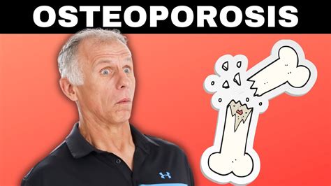 Best Exercises For Osteopenia Of The Spine – Online degrees