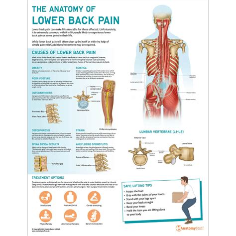 The Anatomy Of Lower Back Pain Low Back Pain Anatomystuff