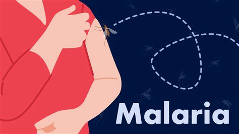 Malaria Symptoms Treatment Prevention Ausmed