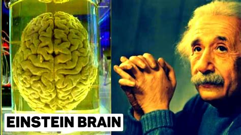 How Einstein S Brain Was Different 15 Unknown Facts About Albert