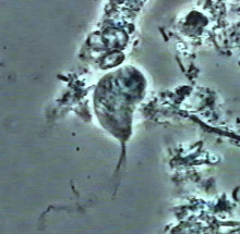 <i>Trichomonas tenax</i> Species of single-celled organism