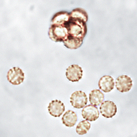 <i>Aphanoascus fulvescens</i> Species of fungus