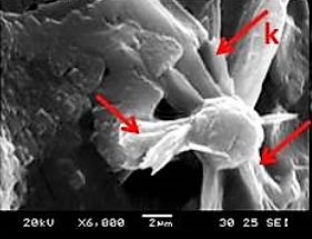 <span class="mw-page-title-main">Thraustochytrids</span> Order of eukaryotes