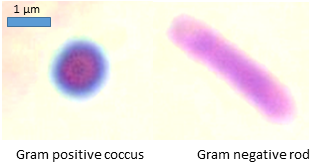 <span class="mw-page-title-main">Gram stain</span> Investigative procedure in microbiology