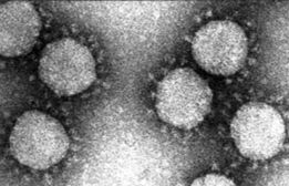 <span class="mw-page-title-main">Transmissible gastroenteritis virus</span> Species of virus