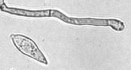 <i>Magnaporthe grisea</i> Blast, fungal disease of rice & wheat