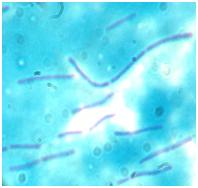 <i>Lactobacillus bulgaricus</i> GLB44 Subspecies of bacterium